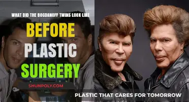 Unveiling the Bogdanoff Twins' Pre-Surgery Appearance: A Transformation Journey