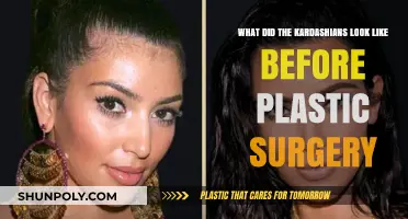Unveiling the Kardashians' Natural Beauty: Pre-Plastic Surgery Transformation