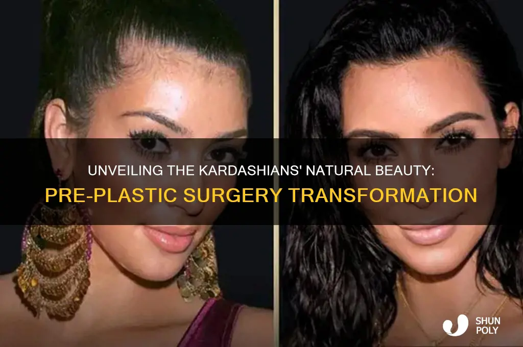 what did the kardashians look like before plastic surgery