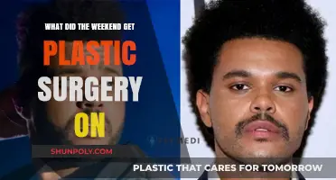 Weekend's Plastic Surgery: Unveiling the Star's Transformative Procedures
