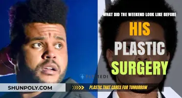 Weekend's Pre-Surgery Transformation: Unveiling His Original Look