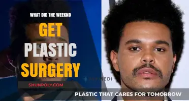 The Weeknd's Transformation: Uncovering His Plastic Surgery Speculations