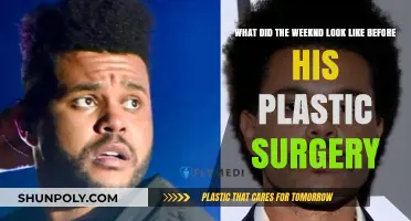 The Weeknd's Pre-Surgery Transformation: Unveiling His Original Look