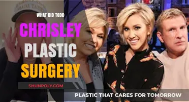 Todd Chrisley's Plastic Surgery Transformation: What Did He Change?