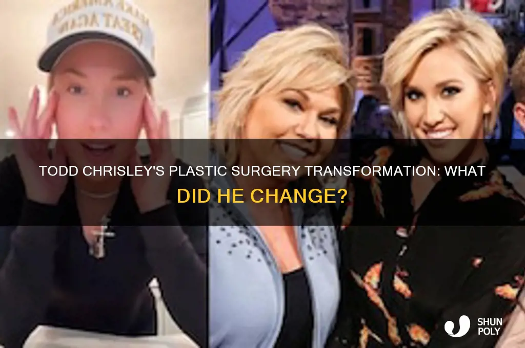 what did todd chrisley plastic surgery