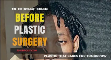 Travis Scott's Transformation: Unveiling His Pre-Surgery Appearance