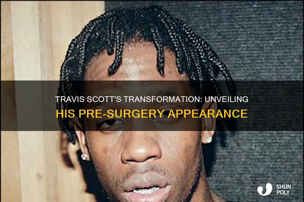 what did travis scott look like before plastic surgery