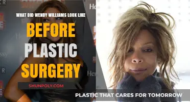 Wendy Williams' Transformation: Unveiling Her Pre-Plastic Surgery Appearance