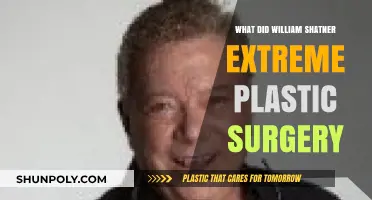 William Shatner's Extreme Plastic Surgery Transformation: Fact or Fiction?