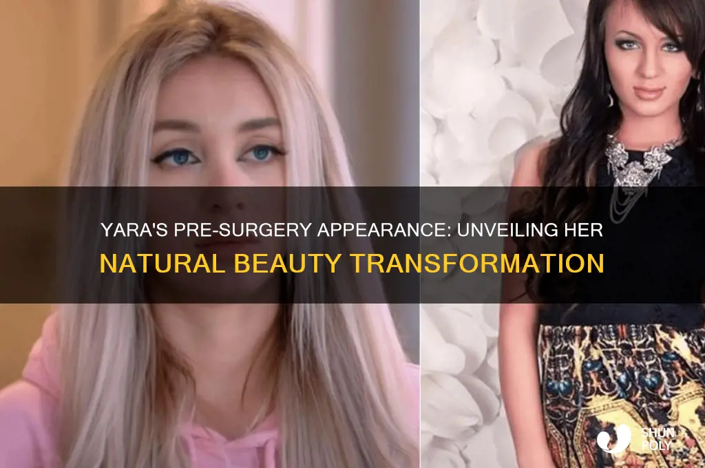 what did yara look like before plastic surgery