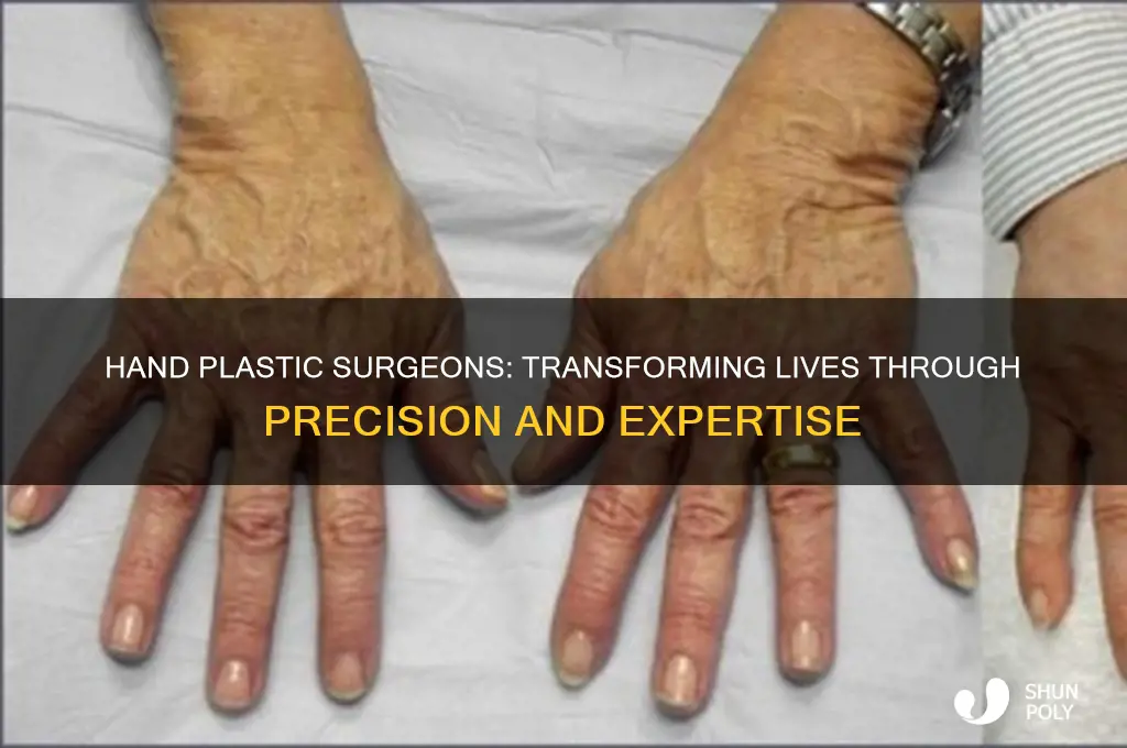 what do hand plastic surgeons