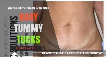 Post-Baby Tummy Tuck: What Plastic Surgeons Term the Procedure