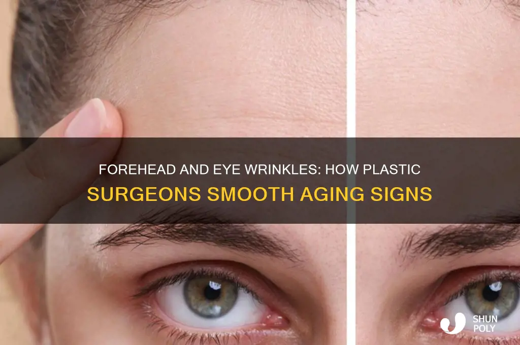 what do plastic surgeons do for forehead and eye wrinkles