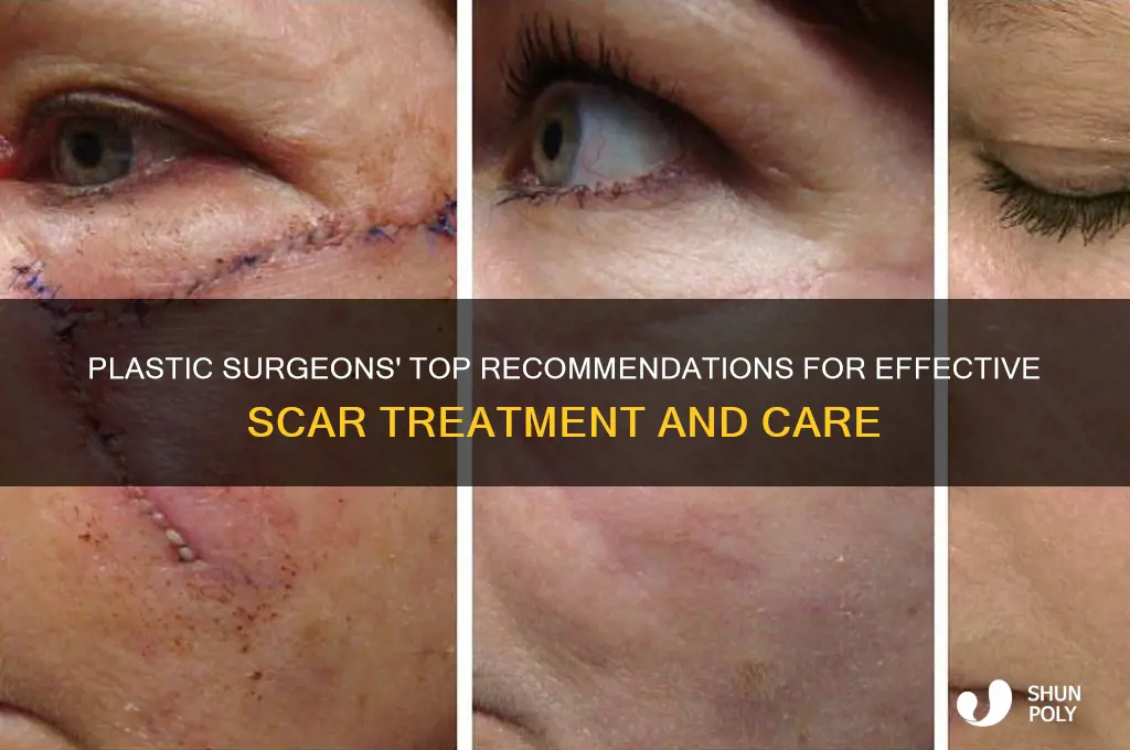 what do plastic surgeons recommend for scars