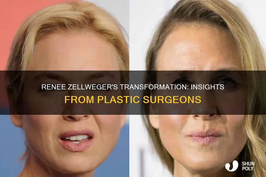 what do plastic surgeons say about renee zellweger
