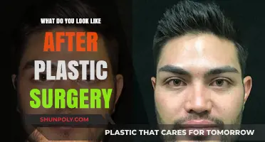 Transformed Faces: Unveiling the New You After Plastic Surgery