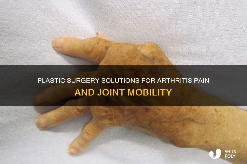 what does a plastic surgeon do for arthritis