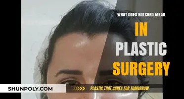 Understanding Botched Plastic Surgery: Causes, Consequences, and Prevention Tips