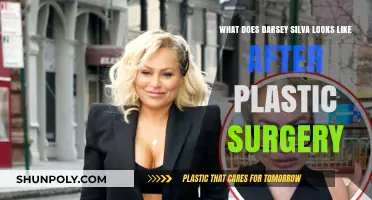 Darsey Silva's Transformed Look: Post-Plastic Surgery Appearance Revealed