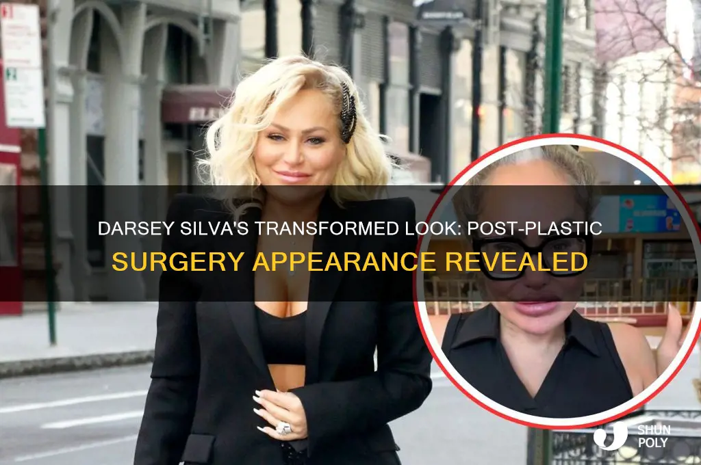 what does darsey silva looks like after plastic surgery