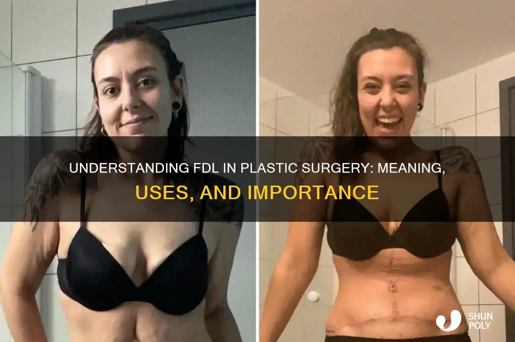 what does fdl stand for in plastic surgery