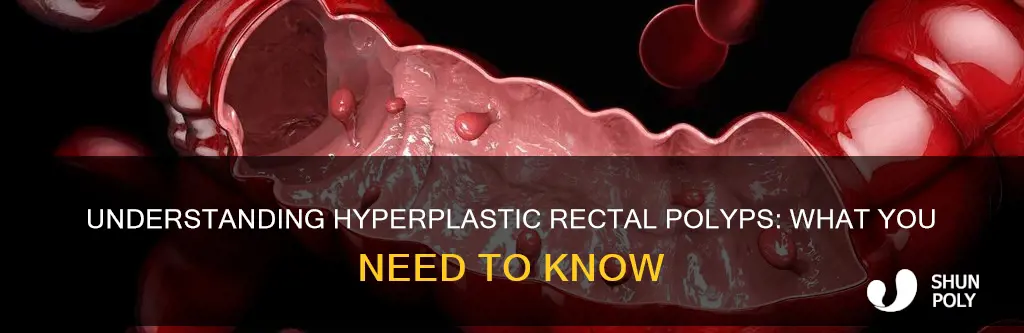 what does hyper plastic rectal polyp mean