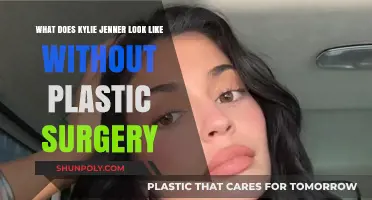 Unveiling Kylie Jenner's Natural Beauty: What She Looks Like Without Plastic Surgery