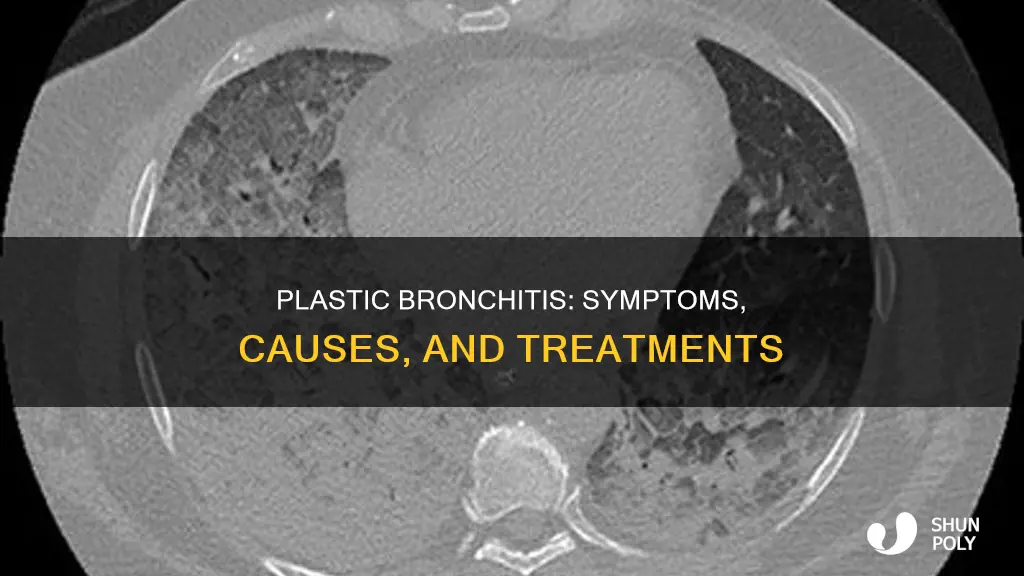 what does plastic bronchitis look like