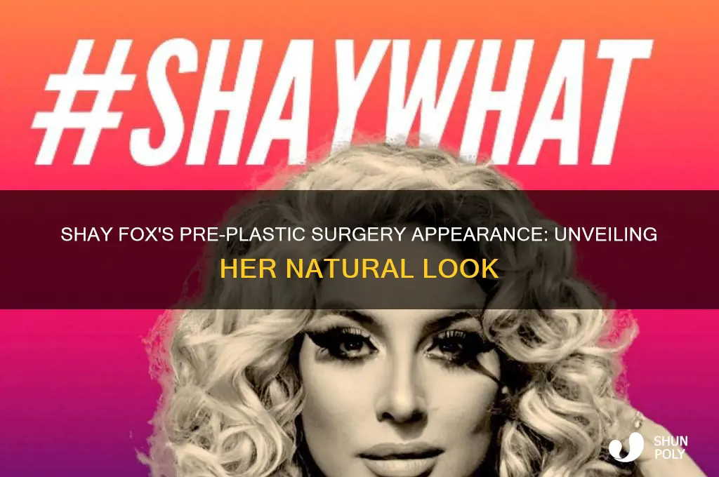 what does shay fox look like before plastic surgery