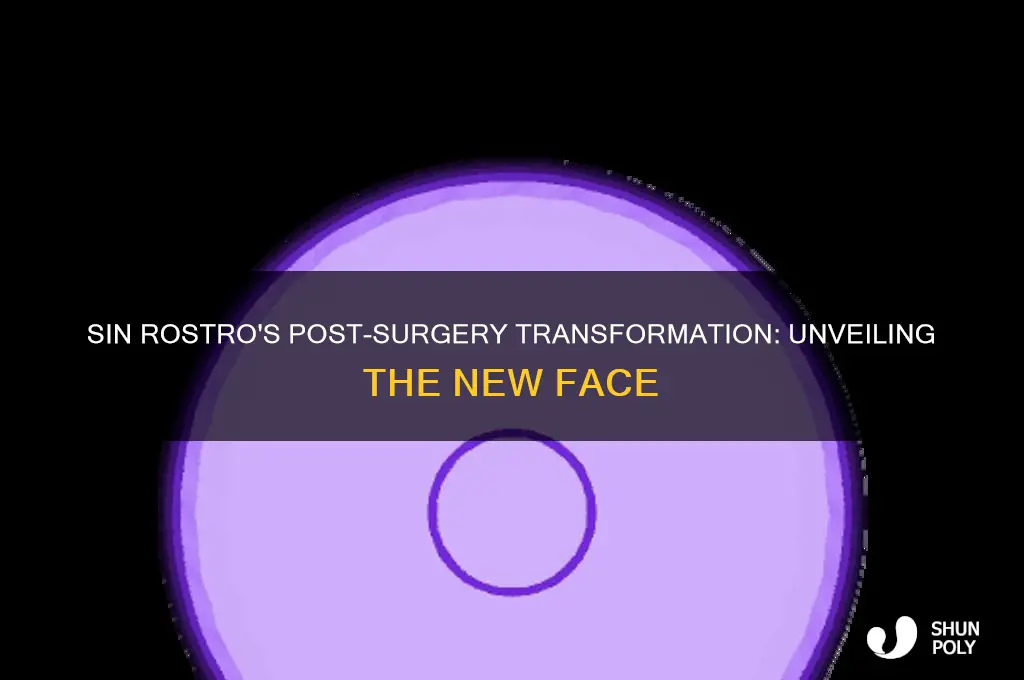 what does sin rostro look like after plastic surgery