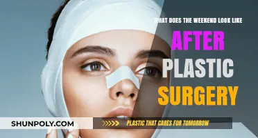 Weekend Recovery: What to Expect After Plastic Surgery