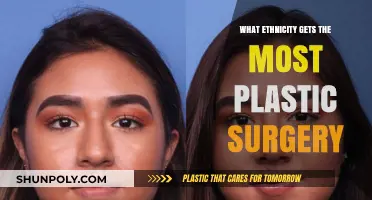 Exploring Ethnic Trends: Which Group Opts for Plastic Surgery Most?
