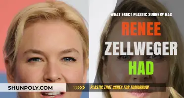 Renee Zellweger's Plastic Surgery: Unveiling Her Transformation Journey