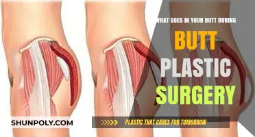 Butt Plastic Surgery: What's Inserted During the Procedure Explained