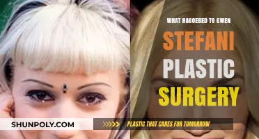 Gwen Stefani's Plastic Surgery Journey: Rumors, Reality, and Transformation