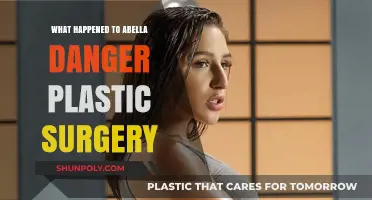Abella Danger's Plastic Surgery Transformation: Rumors, Facts, and Results