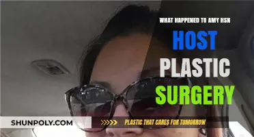 Amy HSN Host's Plastic Surgery Transformation: What Really Happened?
