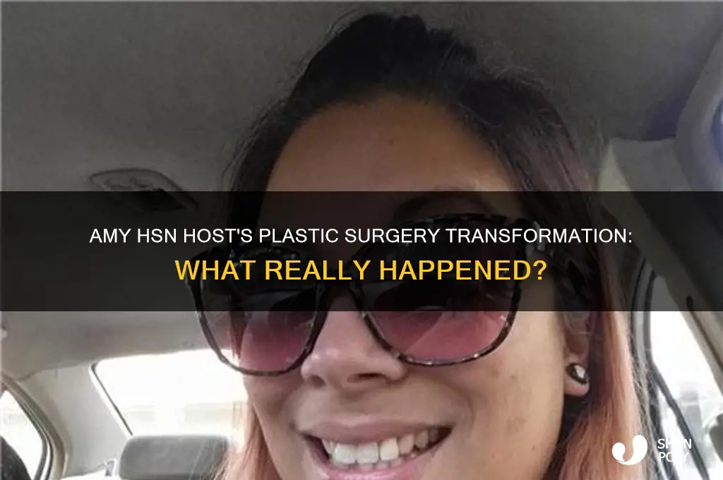 what happened to amy hsn host plastic surgery