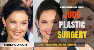 Ashley Judd's Plastic Surgery: Unraveling the Truth Behind the Rumors
