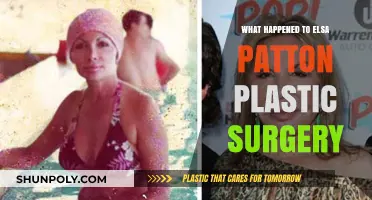 Elsa Patton's Plastic Surgery Transformation: What Really Happened?