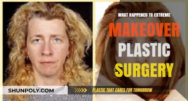 Extreme Makeover Plastic Surgery: The Rise, Fall, and Lasting Impact