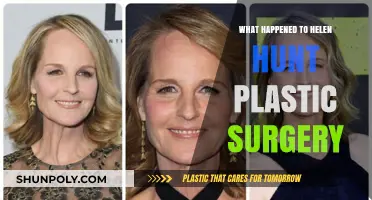 Helen Hunt's Plastic Surgery: Unraveling the Truth Behind Her Transformation