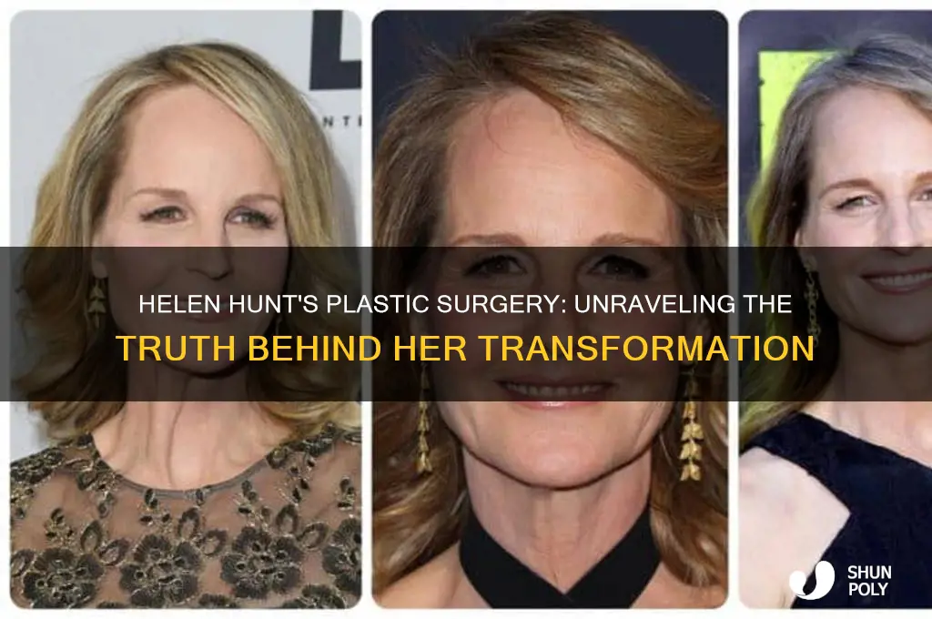 what happened to helen hunt plastic surgery