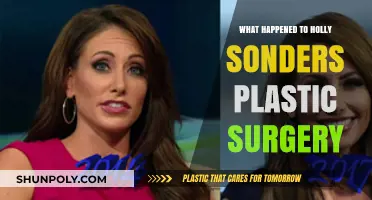 Holly Sonders Plastic Surgery: Unveiling the Truth Behind Her Transformation