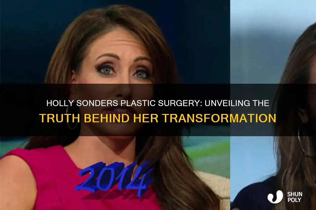 what happened to holly sonders plastic surgery