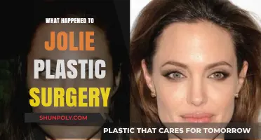 Jolie's Plastic Surgery Transformation: Unveiling the Truth and Aftermath
