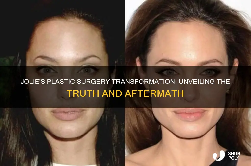 what happened to jolie plastic surgery