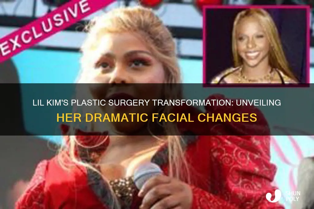 what happened to lil kim face with plastic surgery