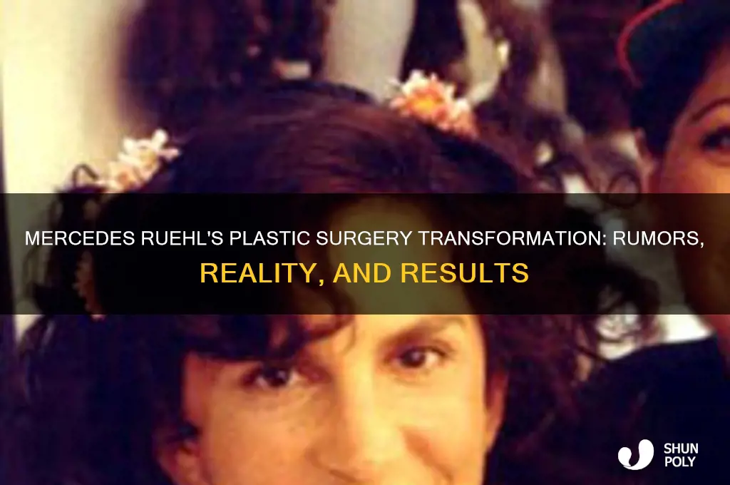 what happened to mercedes ruehl plastic surgery