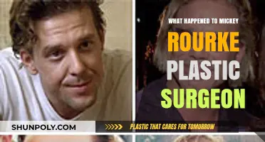 Mickey Rourke's Plastic Surgery: Unraveling the Truth Behind the Transformation